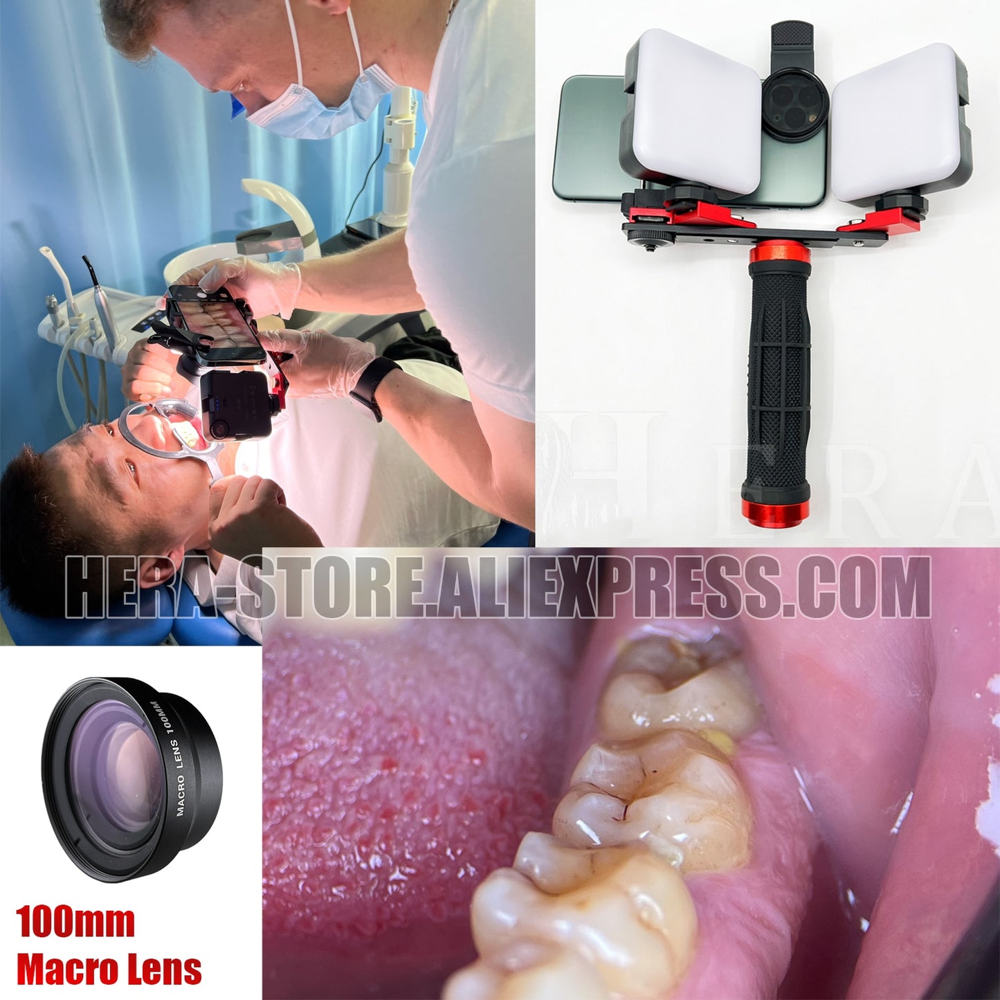 Mobile Photography LED Light Phone Photo Video Flashlight Lighting for Macro, Nail, Dental, Manicure and Makeup Photography